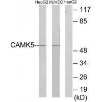 CAMK5