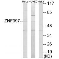 ZNF397