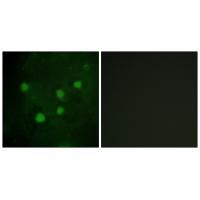 Rabbit Polyclonal Antibody to BAF250B