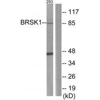 BRSK1