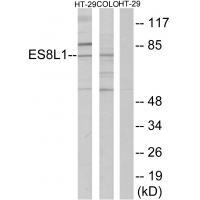 ES8L1