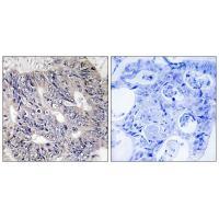Rabbit Polyclonal Antibody to ES8L1