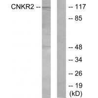 CNKR2