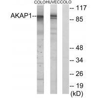 AKAP1