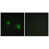 Rabbit Polyclonal Antibody to AKAP1