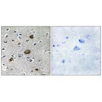 Rabbit Polyclonal Antibody to AKAP1