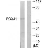 FOXJ1