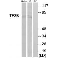 TF3B
