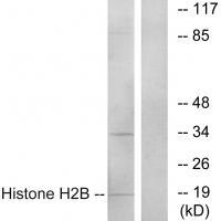 Histone H2B