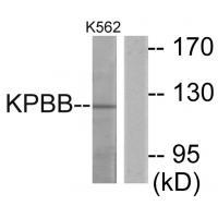 KPBB