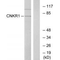 CNKR1
