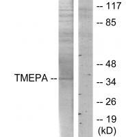 TMEPA