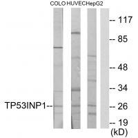 TP53INP1