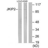 JKIP2