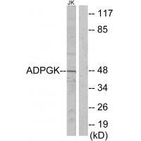 ADPGK