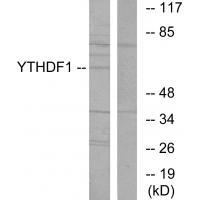 YTHDF1