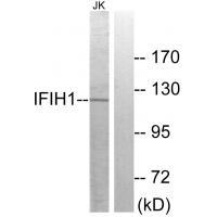 IFIH1