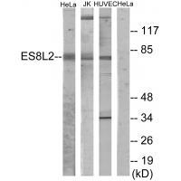 ES8L2