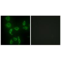 Rabbit Polyclonal Antibody to IARS2