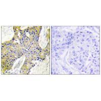 Rabbit Polyclonal Antibody to IARS2