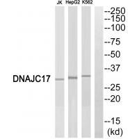 DNAJC17