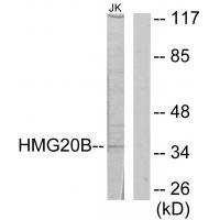 HMG20B