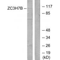 ZC3H7B