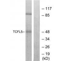TCFL5