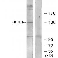 PKCB1