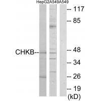 CHKB