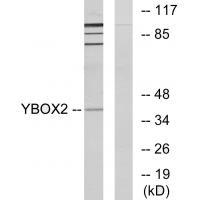 YBOX2