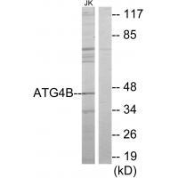 ATG4B