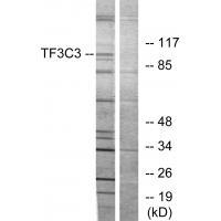 TF3C3