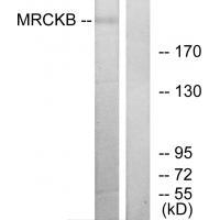 MRCKB