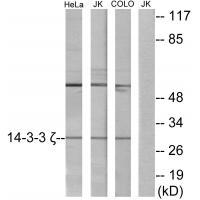 14-3-3 ζ