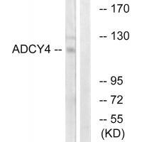 ADCY4