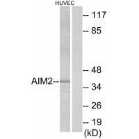 AIM2