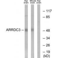 ARRDC3