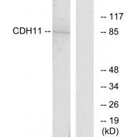 CDH11