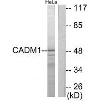 CADM1