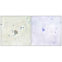 Rabbit Polyclonal Antibody to CELSR3