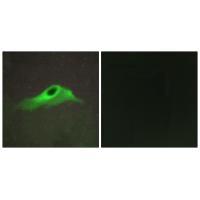 Collagen IV α5
