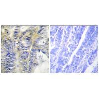 Rabbit Polyclonal Antibody to Collagen IV α5