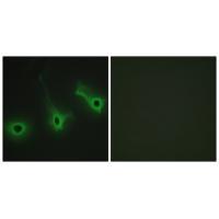 Collagen V α3