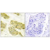Rabbit Polyclonal Antibody to Collagen V α3