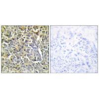 Rabbit Polyclonal Antibody to Collagen VI α2