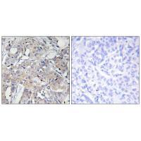 Rabbit Polyclonal Antibody to Collagen VI α3
