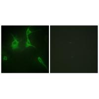Collagen IX α3