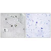 Collagen XI α2