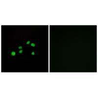 Collagen XXIII α1